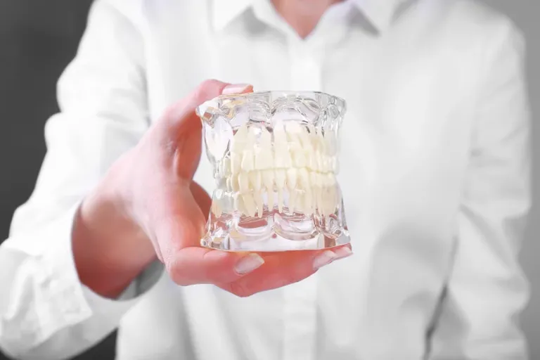 Porzellankronen und -brücken